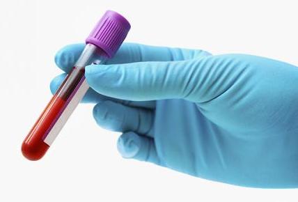 diagnostico diabetes endocrinologista