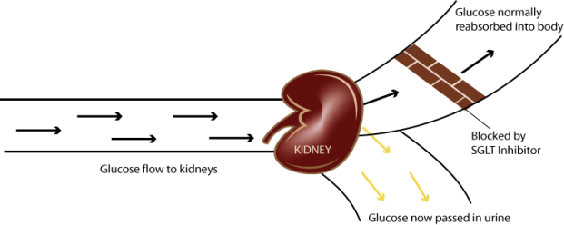 glicosuricos tratamento diabetes endocrinologista