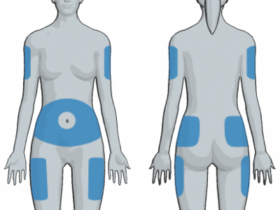 insulina locais aplicacao diabetes